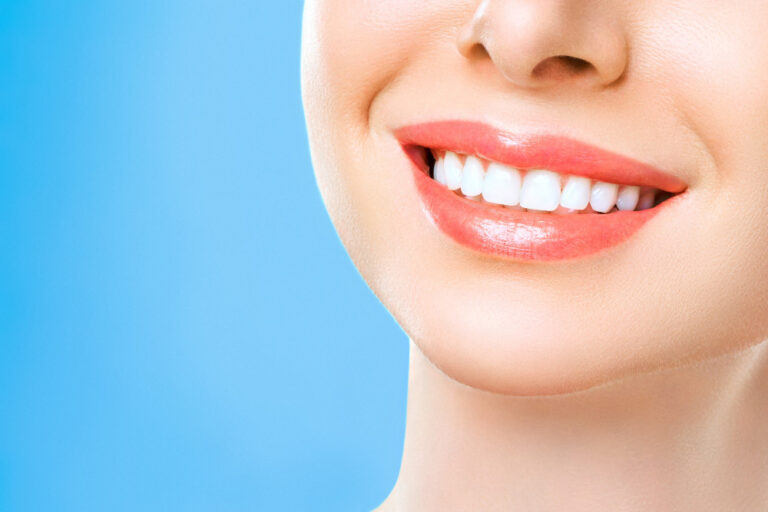 4 tips som ger dig vita tänder